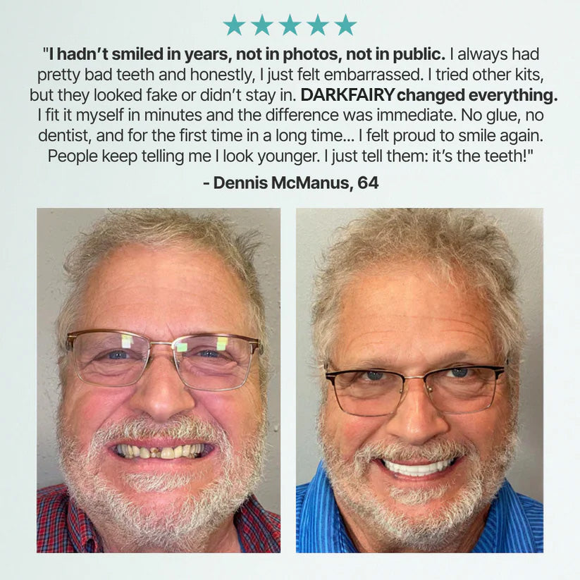 '-DarkFairy™ Custom-Fit Dentures — Designed for Comfort and a Natural-Looking Smile