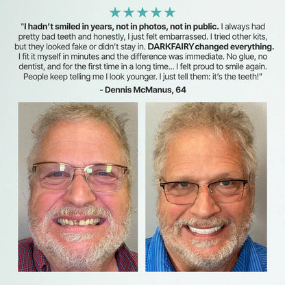 '-DarkFairy™ Custom-Fit Dentures — Designed for Comfort and a Natural-Looking Smile