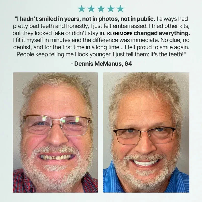 🌎Limited-Time Sale Ends Easter! ⏰HazyGalaxy™ Medical Full Denture with Strong Suctiond🦷